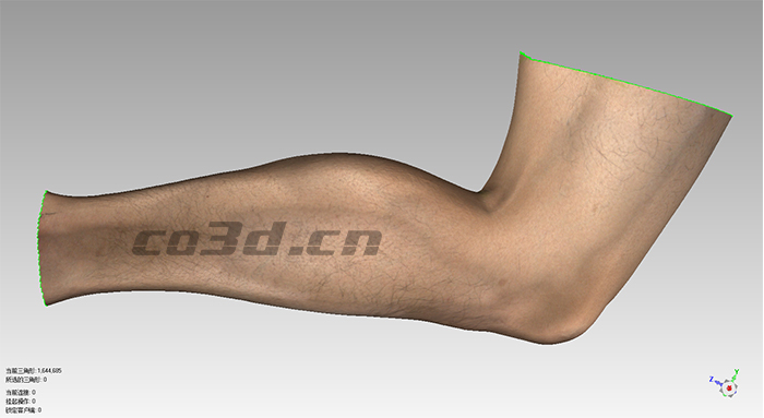 3D scanning of human legs