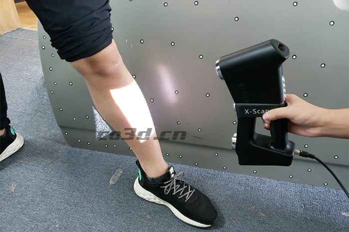 3D scanning of human legs